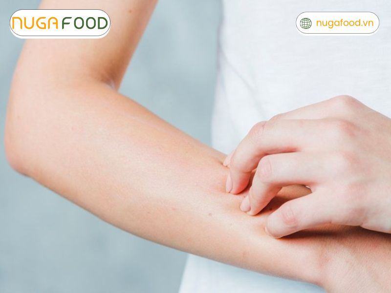 Người bị dị ứng với đậu không nên ăn tempeh đậu gà do nguy cơ xảy ra phản ứng dị ứng